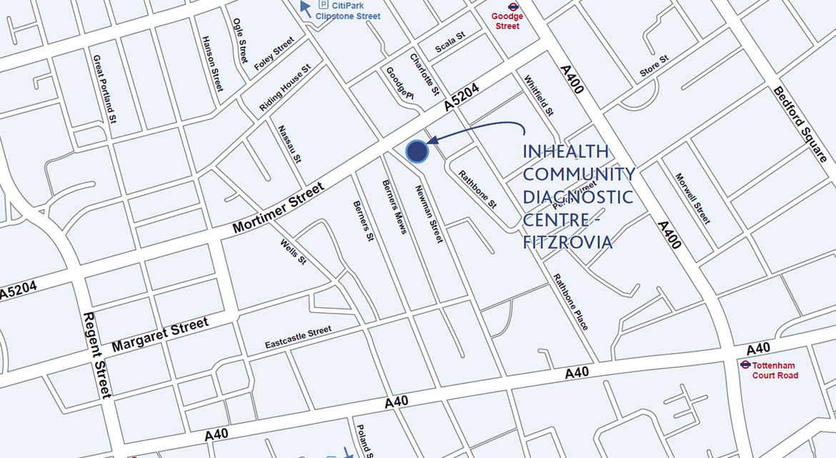 Fitzrovia Community Diagnostic Centre InHealth fitzrovia-community-diagnostic-centre-inhealth